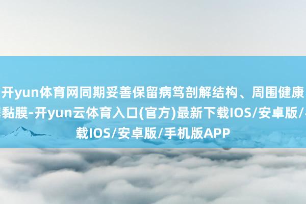 开yun体育网同期妥善保留病笃剖解结构、周围健康鼻腔和鼻窦黏膜-开yun云体育入口(官方)最新下载IOS/安卓版/手机版APP